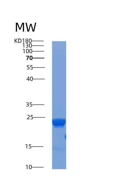SDS-PAGE analysis of Human ACP1 (Low Molecular Weight Phosphotyrosine Protein Phosphatase) - Recombinant Protein, showing >95% purity under 15% SDS-PAGE (Reduced)