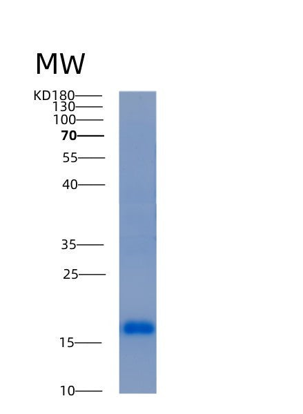 SDS-PAGE analysis of Human ACOT13 (Acyl-Coenzyme A Thioesterase 13) - Recombinant Protein, showing >95% purity under 15% SDS-PAGE (Reduced)