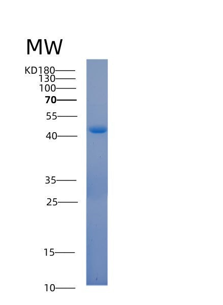 SDS-PAGE analysis of Human ACOT7 (Cytosolic Acyl Coenzyme A Thioester Hydrolase) - Recombinant Protein, showing >90% purity under 15% SDS-PAGE (Reduced)