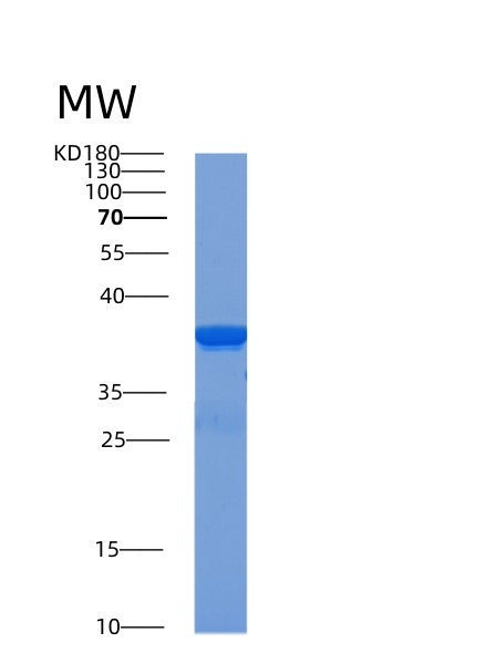 SDS-PAGE analysis of Human ACOT8 (Acyl-Coenzyme A Thioesterase 8) - Recombinant Protein, showing >90% purity under 15% SDS-PAGE (Reduced)