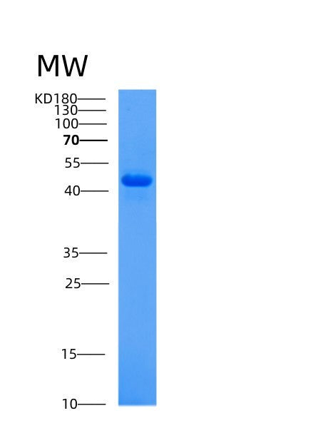 SDS-PAGE analysis of Human ACP2 (Lysosomal Acid Phosphatase) - Recombinant Protein, showing >95% purity under 15% SDS-PAGE (Reduced)
