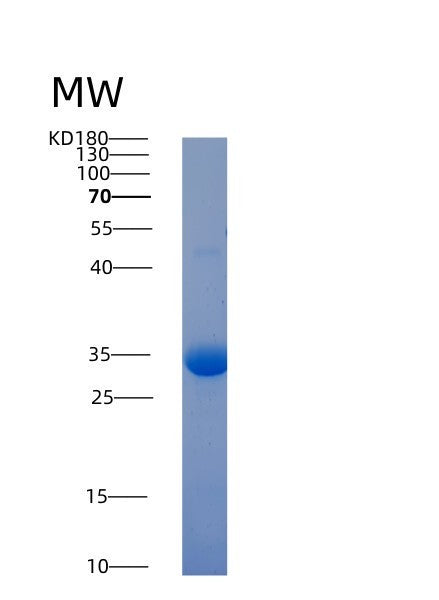 SDS-PAGE analysis of Human ACP5 (Tartrate-Resistant Acid Phosphatase Type 5) - Recombinant Protein, showing >90% purity under 15% SDS-PAGE (Reduced)