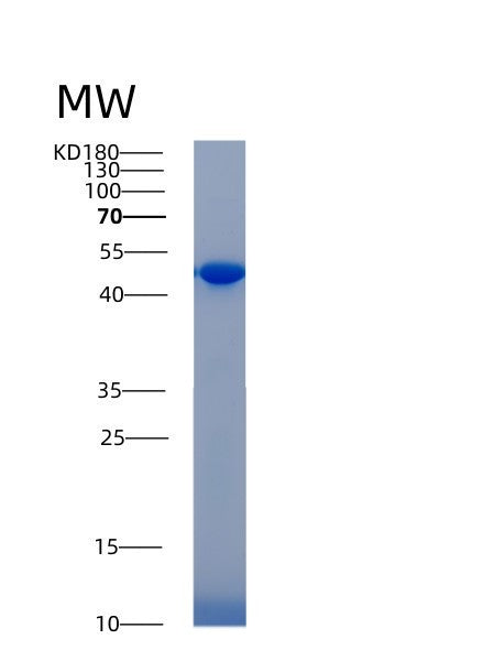 SDS-PAGE analysis of Human ACP3 (Prostatic Acid Phosphatase) - Recombinant Protein, showing >90% purity under 15% SDS-PAGE (Reduced)