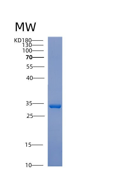 SDS-PAGE analysis of Human ACTN1 (Alpha-Actinin-1) - Recombinant Protein, showing >95% purity under 15% SDS-PAGE (Reduced)