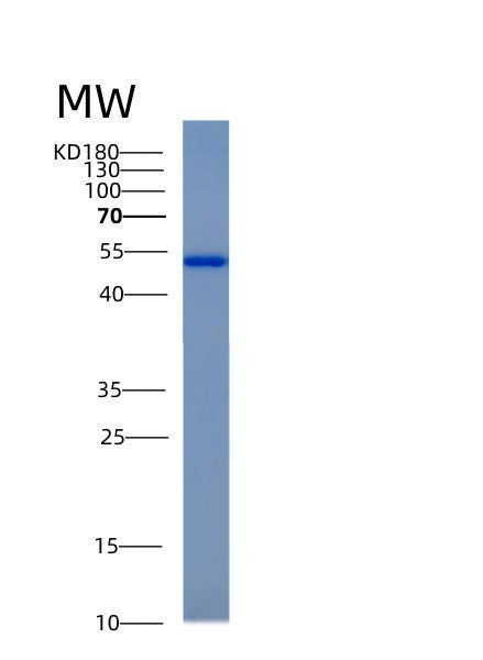 SDS-PAGE analysis of Human ACY1 (Aminoacylase-1) - Recombinant Protein, showing >95% purity under 15% SDS-PAGE (Reduced)