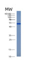 SDS-PAGE analysis of Human ACY1 (Aminoacylase-1) - Recombinant Protein, showing >95% purity under 15% SDS-PAGE (Reduced)