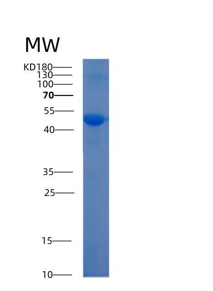 SDS-PAGE analysis of Human ADAM10 (Disintegrin And Metalloproteinase Domain-Containing Protein 10) - Recombinant Protein, showing >90% purity under 15% SDS-PAGE (Reduced)