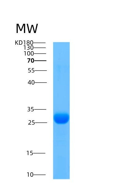 SDS-PAGE analysis of Human AK3 (Gtp:Amp Phosphotransferase Ak3, Mitochondrial) - Recombinant Protein, showing >85% purity under 15% SDS-PAGE (Reduced)