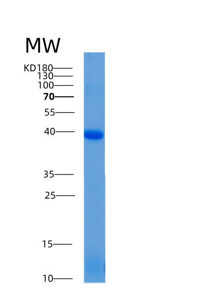 SDS-PAGE analysis of Human ADH1A (Alcohol Dehydrogenase 1A) - Recombinant Protein, showing >90% purity under 15% SDS-PAGE (Reduced)