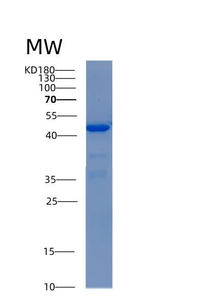 SDS-PAGE analysis of Human ADH5 (Alcohol Dehydrogenase Class-3) - Recombinant Protein, showing >90% purity under 15% SDS-PAGE (Reduced)