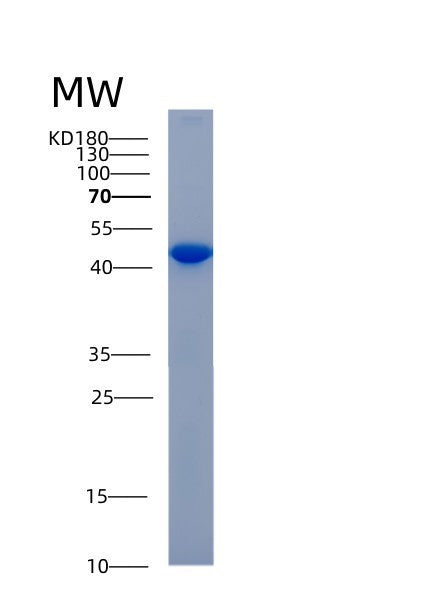 SDS-PAGE analysis of Human ADH6 (Alcohol Dehydrogenase 6) - Recombinant Protein, showing >85% purity under 15% SDS-PAGE (Reduced)