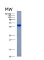 SDS-PAGE analysis of Human ADH6 (Alcohol Dehydrogenase 6) - Recombinant Protein, showing >85% purity under 15% SDS-PAGE (Reduced)