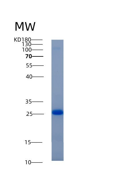 SDS-PAGE analysis of Human ADI1 (Acireductone Dioxygenase) - Recombinant Protein, showing >95% purity under 15% SDS-PAGE (Reduced)