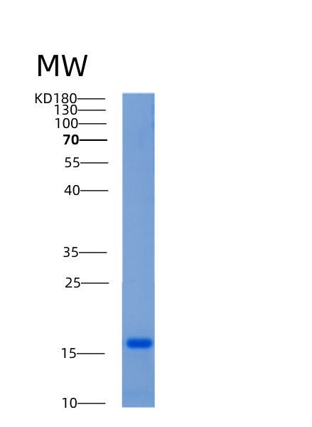 SDS-PAGE analysis of Mouse Adipor1 (Adiponectin Receptor Protein 1) - Recombinant Protein, showing >85% purity under 15% SDS-PAGE (Reduced)