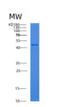 SDS-PAGE analysis of Human ADPRH (Adp-Ribosylhydrolase Arh1) - Recombinant Protein, showing >90% purity under 15% SDS-PAGE (Reduced)