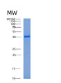SDS-PAGE analysis of Human ADPRS (Adp-Ribosylhydrolase Arh3) - Recombinant Protein, showing >85% purity under 15% SDS-PAGE (Reduced)