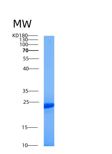 SDS-PAGE analysis of Human TLE5 (Tle Family Member 5) - Recombinant Protein, showing >85% purity under 15% SDS-PAGE (Reduced)