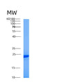 SDS-PAGE analysis of Human TLE5 (Tle Family Member 5) - Recombinant Protein, showing >85% purity under 15% SDS-PAGE (Reduced)