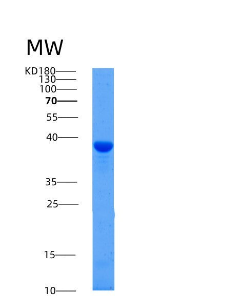 SDS-PAGE analysis of Human AFAP1 (Actin Filament-Associated Protein 1) - Recombinant Protein, showing >95% purity under 15% SDS-PAGE (Reduced)