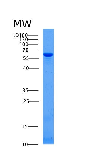 SDS-PAGE analysis of Human AFP (Alpha-Fetoprotein) - Recombinant Protein, showing >90% purity under 15% SDS-PAGE (Reduced)