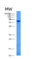 SDS-PAGE analysis of Human AFP (Alpha-Fetoprotein) - Recombinant Protein, showing >90% purity under 15% SDS-PAGE (Reduced)