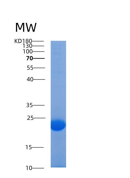 SDS-PAGE analysis of Human AGR2 (Anterior Gradient Protein 2 Homolog) - Recombinant Protein, showing >90% purity under 15% SDS-PAGE (Reduced)