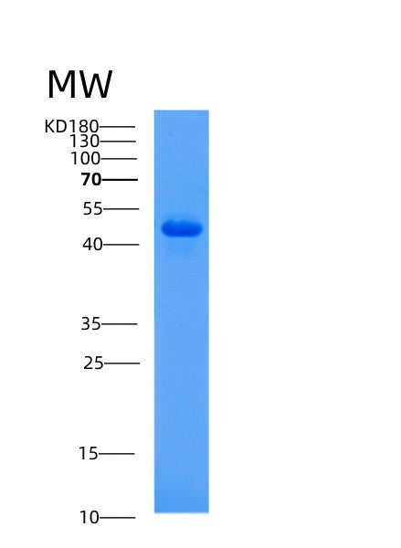SDS-PAGE analysis of Human AHCY (Adenosylhomocysteinase) - Recombinant Protein, showing >85% purity under 15% SDS-PAGE (Reduced)