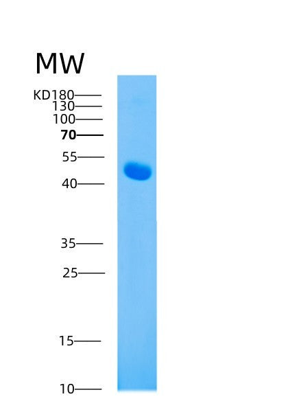 SDS-PAGE analysis of Mouse Ahsg (Alpha-2-Hs-Glycoprotein) - Recombinant Protein, showing >95% purity under 15% SDS-PAGE (Reduced)
