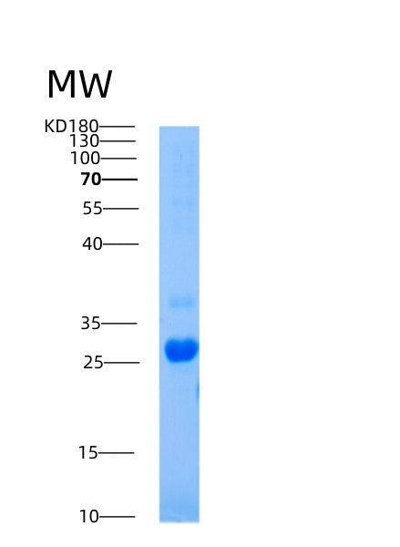 SDS-PAGE analysis of Human AICDA (Single-Stranded Dna Cytosine Deaminase) - Recombinant Protein, showing >95% purity under 15% SDS-PAGE (Reduced)