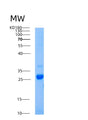 SDS-PAGE analysis of Human AICDA (Single-Stranded Dna Cytosine Deaminase) - Recombinant Protein, showing >95% purity under 15% SDS-PAGE (Reduced)