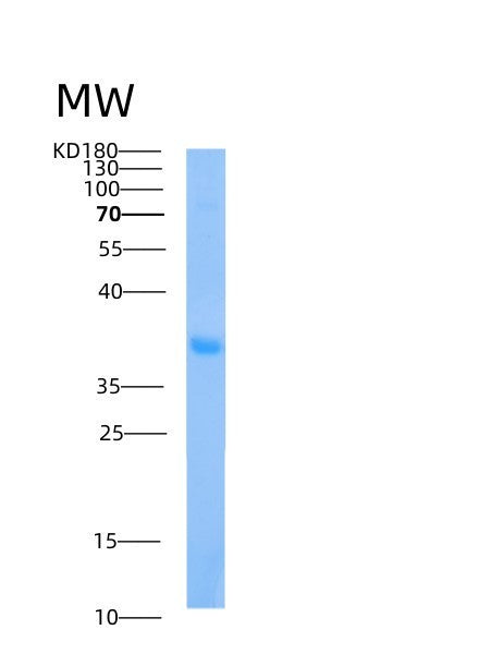 SDS-PAGE analysis of Human AIDA (Axin Interactor, Dorsalization-Associated Protein) - Recombinant Protein, showing >90% purity under 15% SDS-PAGE (Reduced)