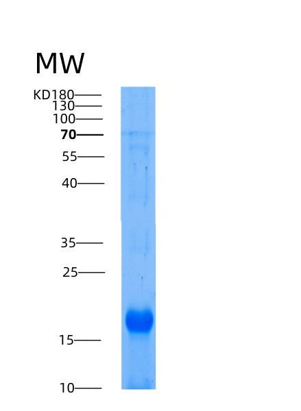 SDS-PAGE analysis of Human AIF1 (Allograft Inflammatory Factor 1) - Recombinant Protein, showing >85% purity under 15% SDS-PAGE (Reduced)