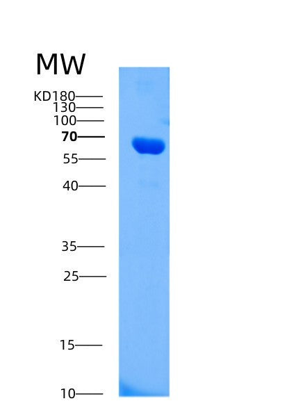 SDS-PAGE analysis of Human AIFM1 (Apoptosis-Inducing Factor 1, Mitochondrial) - Recombinant Protein, showing >90% purity under 15% SDS-PAGE (Reduced)