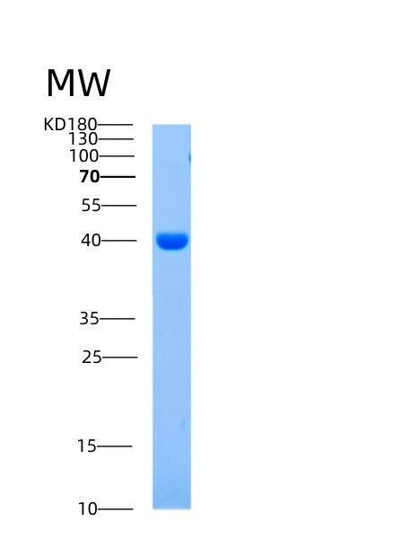 SDS-PAGE analysis of Human AIMP1 (Aminoacyl Trna Synthase Complex-Interacting Multifunctional Protein 1) - Recombinant Protein, showing >95% purity under 15% SDS-PAGE (Reduced)
