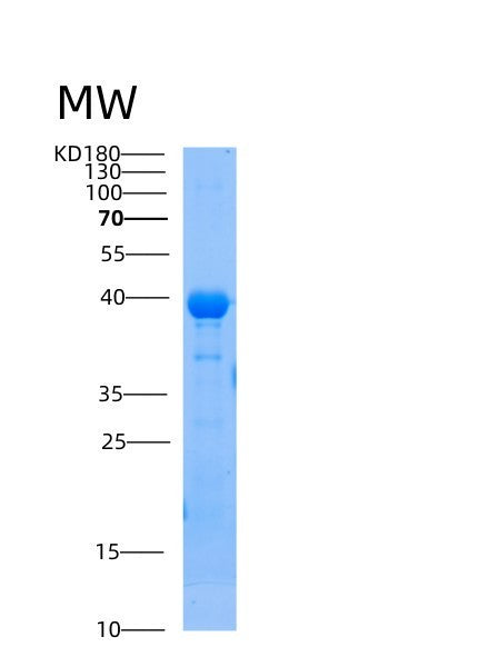 SDS-PAGE analysis of Human AIP (Ah Receptor-Interacting Protein) - Recombinant Protein, showing >85% purity under 15% SDS-PAGE (Reduced)