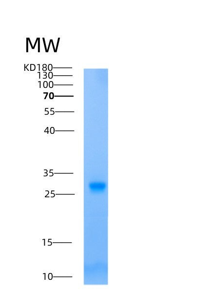 SDS-PAGE analysis of Human Adenylate Kinase 2 (AK2) - Recombinant Protein, showing >90% purity under 15% SDS-PAGE (Reduced)