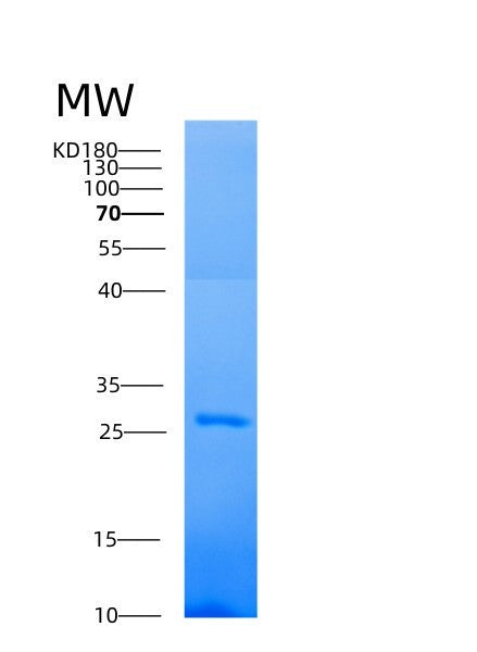 SDS-PAGE analysis of Human AK4 (Adenylate Kinase 4, Mitochondrial) - Recombinant Protein, showing >85% purity under 15% SDS-PAGE (Reduced)