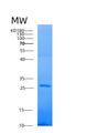 SDS-PAGE analysis of Human AK4 (Adenylate Kinase 4, Mitochondrial) - Recombinant Protein, showing >85% purity under 15% SDS-PAGE (Reduced)