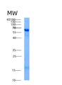 SDS-PAGE analysis of Human AK5 (Adenylate Kinase Isoenzyme 5) - Recombinant Protein, showing >95% purity under 15% SDS-PAGE (Reduced)