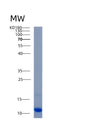 SDS-PAGE analysis of Human AKAP7 (A-Kinase Anchor Protein 7 Isoform Gamma) - Recombinant Protein, showing >90% purity under 15% SDS-PAGE (Reduced)
