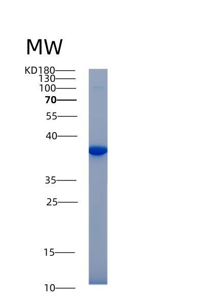 SDS-PAGE analysis of Mouse Akr1b1 (Aldo-Keto Reductase Family 1 Member B1) - Recombinant Protein, showing >85% purity under 15% SDS-PAGE (Reduced)