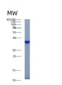SDS-PAGE analysis of Mouse Akr1b1 (Aldo-Keto Reductase Family 1 Member B1) - Recombinant Protein, showing >85% purity under 15% SDS-PAGE (Reduced)