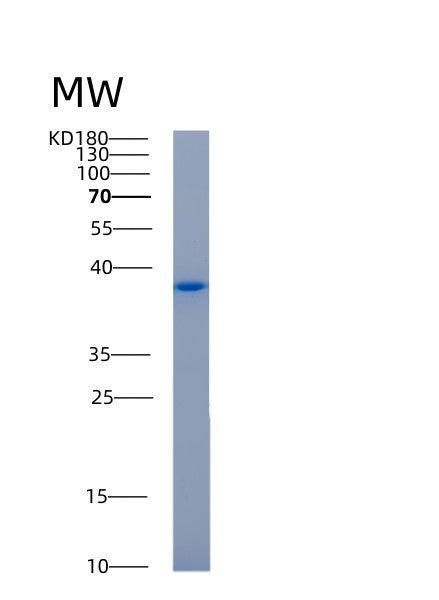 SDS-PAGE analysis of Human AKR1C1 (Aldo-Keto Reductase Family 1 Member C1) - Recombinant Protein, showing >90% purity under 15% SDS-PAGE (Reduced)