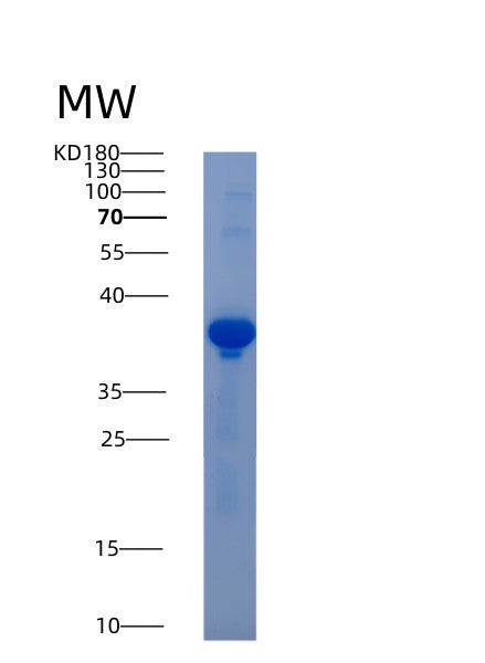 SDS-PAGE analysis of Human AKR1D1 (Aldo-Keto Reductase Family 1 Member D1) - Recombinant Protein, showing >90% purity under 15% SDS-PAGE (Reduced)