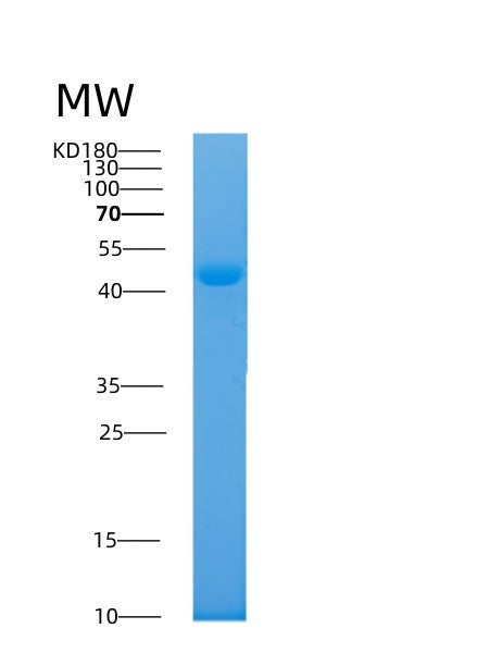 SDS-PAGE analysis of Human AKR7A2 (Aflatoxin B1 Aldehyde Reductase Member 2) - Recombinant Protein, CAT# BLT-08366P showing >95% purity under 15% SDS-PAGE (Reduced)