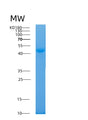 SDS-PAGE analysis of Human AKR7A2 (Aflatoxin B1 Aldehyde Reductase Member 2) - Recombinant Protein, CAT# BLT-08366P showing >95% purity under 15% SDS-PAGE (Reduced)