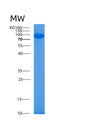 SDS-PAGE analysis of Human AARS1 (Alanine--Trna Ligase, Cytoplasmic) - Recombinant Protein, showing >95% purity under 15% SDS-PAGE (Reduced)