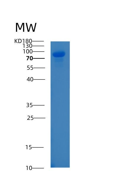 SDS-PAGE analysis of Human ALCAM (Cd166 Antigen) - Recombinant Protein, showing >85% purity under 15% SDS-PAGE (Reduced)