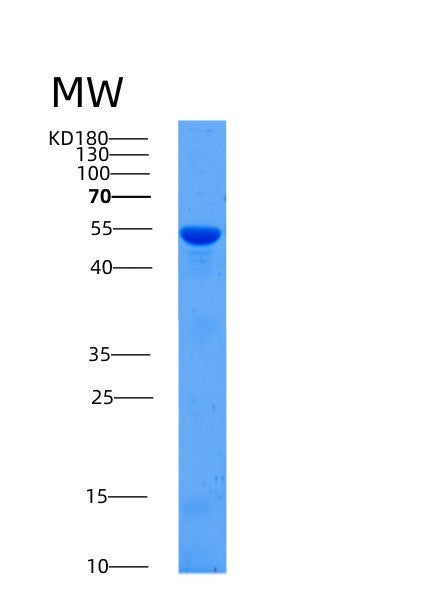 SDS-PAGE analysis of Human ALDH1A1 (Aldehyde Dehydrogenase 1A1) - Recombinant Protein, showing >90% purity under 15% SDS-PAGE (Reduced)