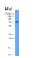 SDS-PAGE analysis of Mouse Aldh2 (Aldehyde Dehydrogenase, Mitochondrial) - Recombinant Protein, showing >85% purity under 15% SDS-PAGE (Reduced)